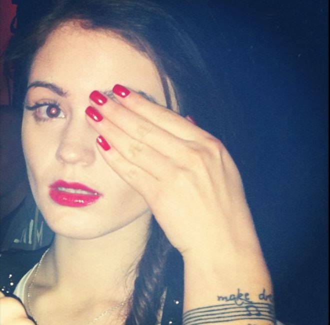 SZOK! Honorata Skarbek przed powiększeniem ust i biustu!