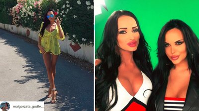 Małgorzata Godlewska MOTYWUJE siostrę po wypadku: Skorzystaj z szansy!