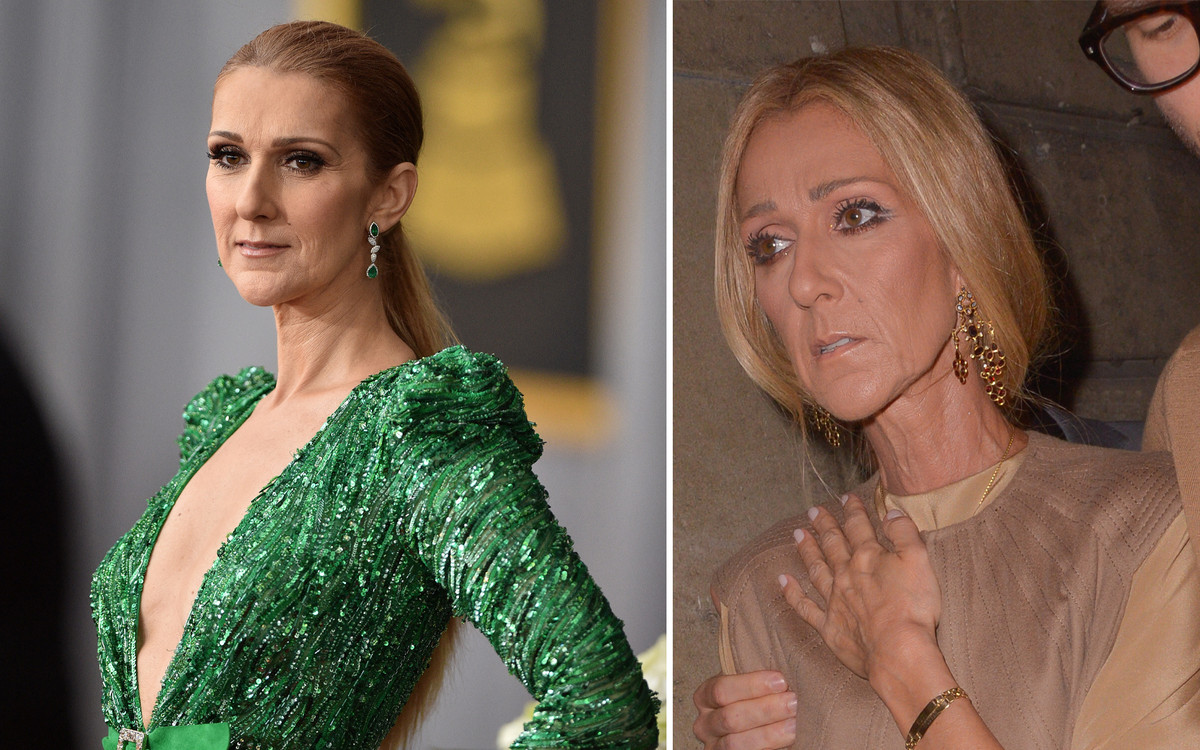 Celine Dion jest w bardzo złym stanie! “Ledwo może się ruszyć”