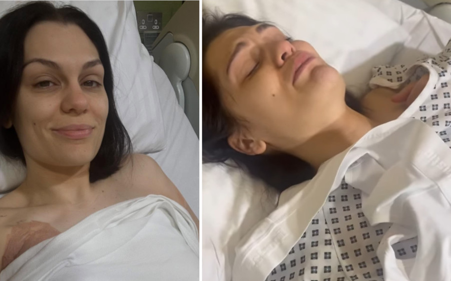 Jessie J zabiera głos po mastektomii. Ujawniła, w jakim jest teraz stanie