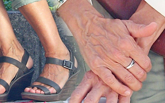 Ci, którzy mówią, że Małgorzata Rozenek-Majdan ma żylaste stopy… (ZDJĘCIA)