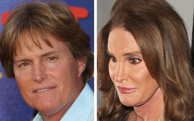 Najgorsze przypadki operacji plastycznych