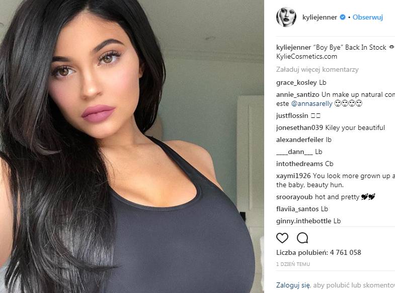Co się dzieje z ustami Kylie?! Na temat jej wielkich warg wypowiedział się EKSPERT