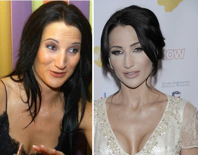 Nie ma ludzi brzydkich, są tylko biedni