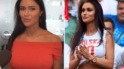 Miss Mundialu została ZAATAKOWANA podczas meczu przez Kolumbijkę!