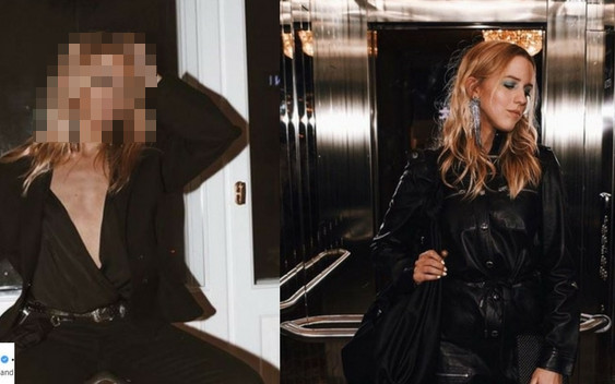 Coś jest nie tam z twarzą Mercedes, a klatka piersiowa: JAK U MĘŻCZYZNY