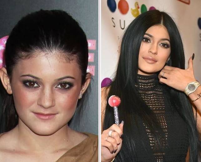 Nie ma ludzi brzydkich, są tylko biedni