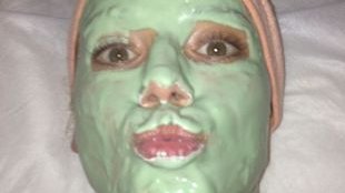 Która polska gwiazda tak cierpi dla piękna? (FOTO+VIDEO)