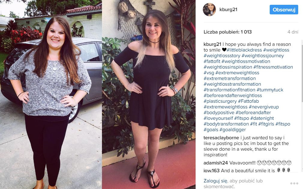 Te zdjęcia pokazują, jak wygląda ciało po zrzuceniu wagi