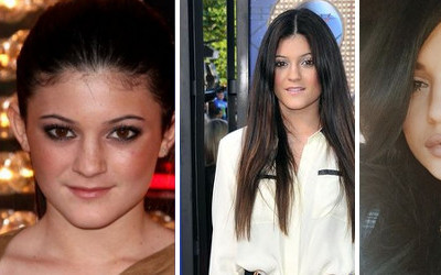 Jak zmieniała się twarz Kylie Jenner? (FOTO)