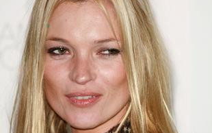 Kate Moss ma pryszcze!