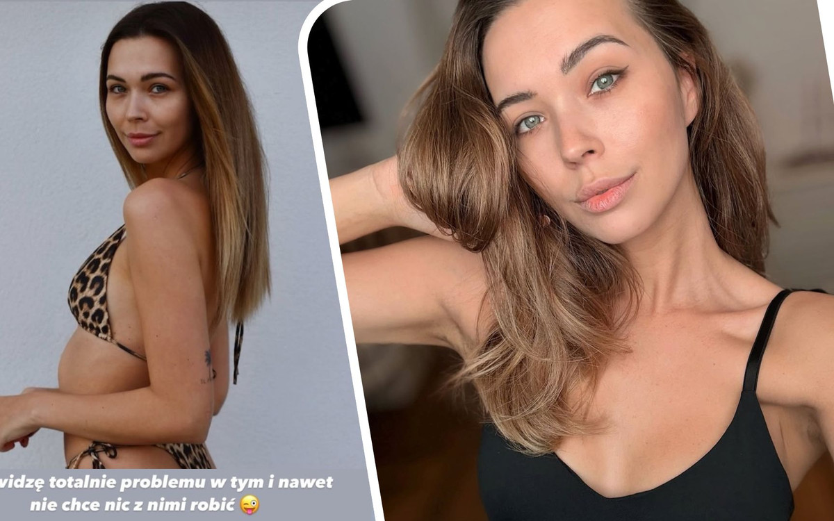 Sandra Kubicka wstawiła zdjęcie z BLIZNAMI po porodzie. Matki zachwycone!