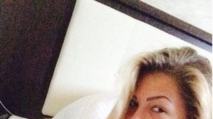 Komu tak spuchły usta? (FOTO)