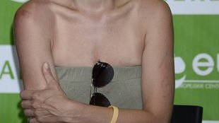 Spalona skóra i rozbite kolano Kasi Glinki (FOTO)