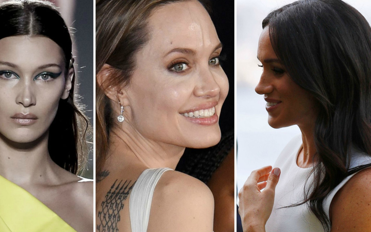 Te gwiazdy zrobiły NOS – mamy zdjęcia, jak wyglądały wcześniej