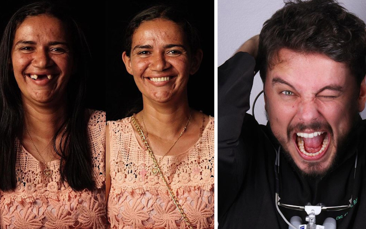 Dentysta wyleczył ZA DARMO zęby BIEDNYM. Efekt niebywały!