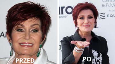Załamana Sharon Osbourne: “koszmarny lifting sprawił, że wyglądam jak cyklop”