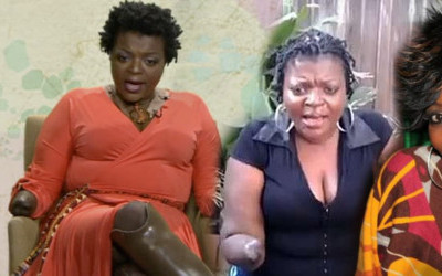 Chciała powiększyć pośladki, została kaleką (FOTO+VIDEO)