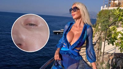 Aneta Glam przeżywa KOSZMAR na wakacjach! “Obudziłam się ze zdeformowaną twarzą”