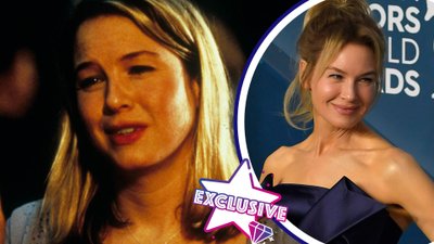 Ile zabiegów i operacji plastycznych przeszła Renée Zellweger? Lekarka odpowiada!
