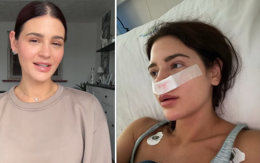 Honorata Skarbek: “Od ponad 10 lat jestem silnie uzależniona…”. Teraz musiała przejść operację! (FOTO)