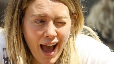 Co się stało z twarzą Hilary Duff?!