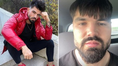 Paweł Tyburski pokazał NOWĄ twarz. Znalazł specjalistę, który naprawił jego wygląd