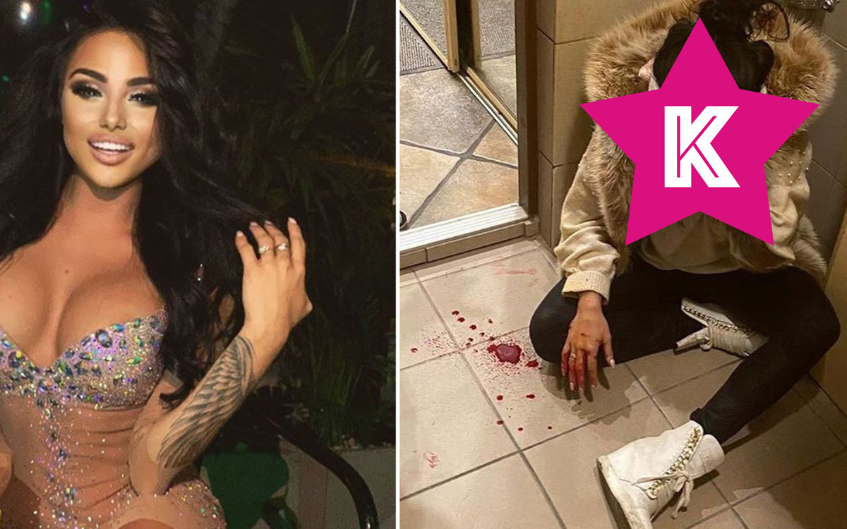 Modelka “CKM” Julia Kupiec została skatowana przez trzech mężczyzn “Tłukli po całym ciele metalowymi pojemnikami gazu”