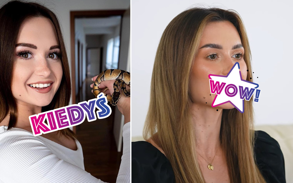 Wersow zrobiła sobie nowe zęby! W komentarzach POGROM: “Zniszczyły Twój wygląd!” (FOTO)