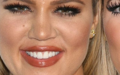 Khloe przyznaje – wypełniacze zniszczyły jej twarz