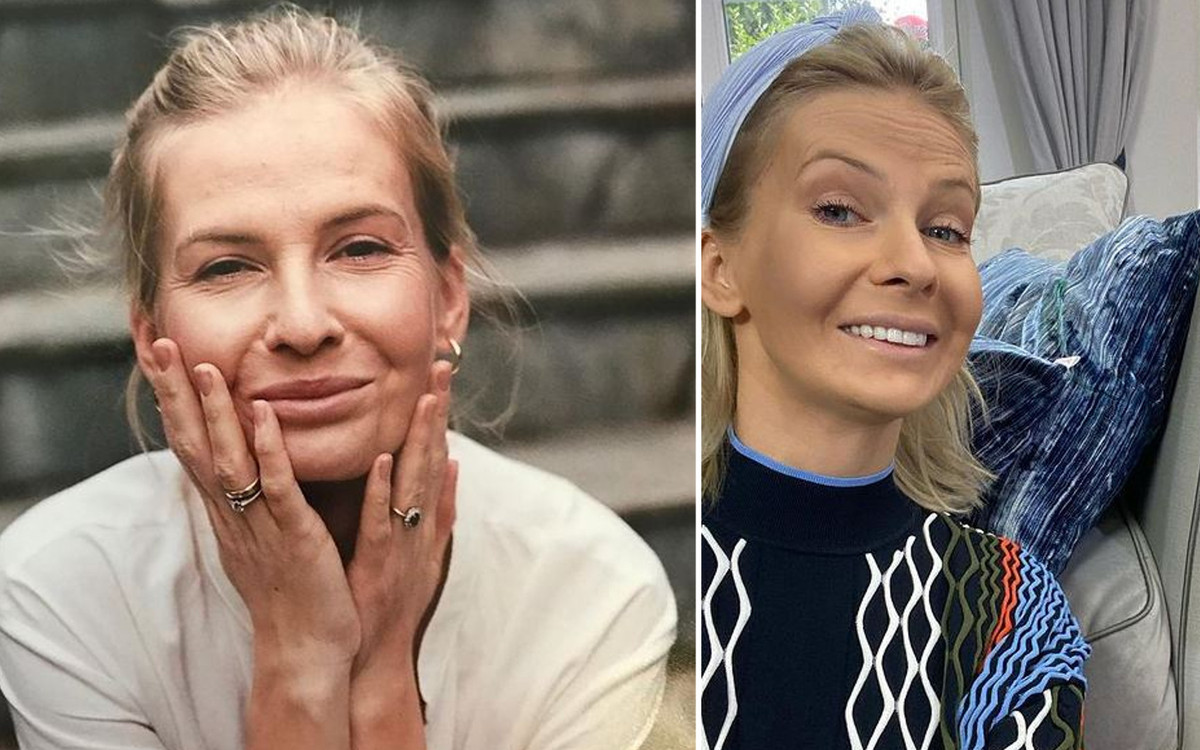 Edyta Pazura opowiedziała o walce z chorobą i pokazała przebarwienia na twarzy