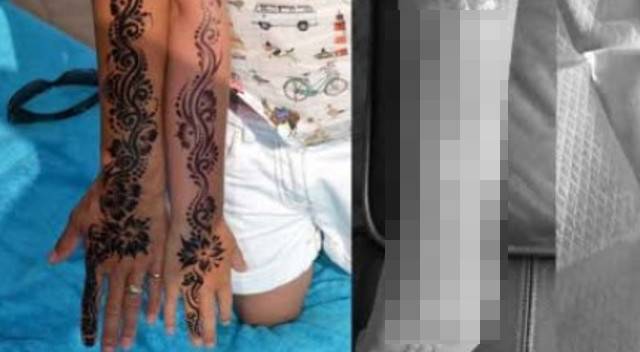 7-latka wykonała na wakacjach tatuaż z henny. Zrobił z jej skórą COŚ STRASZNEGO