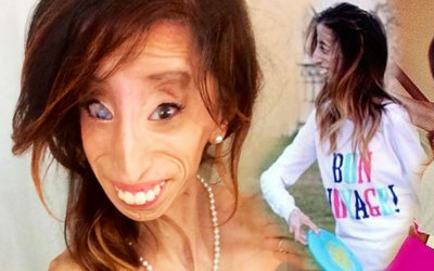 Lizzie Velasquez zwana najbrzydszą kobietą świata… (FOTO)
