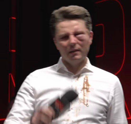 Piotr Korczarowski pobity, fot. Youtube