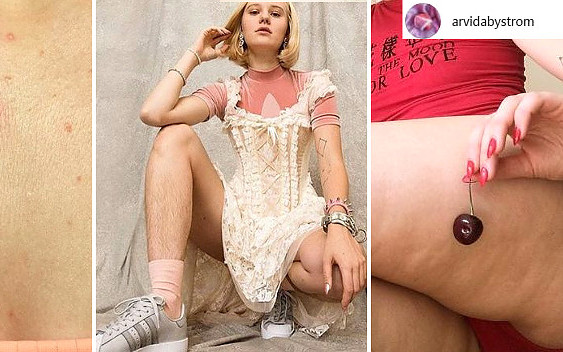 Szwedzka modelka pokazuje krosty, cellulit i włosy na nogach (ZDJĘCIA)