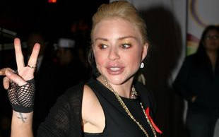 Casey Johnson zmarła z zaniedbania