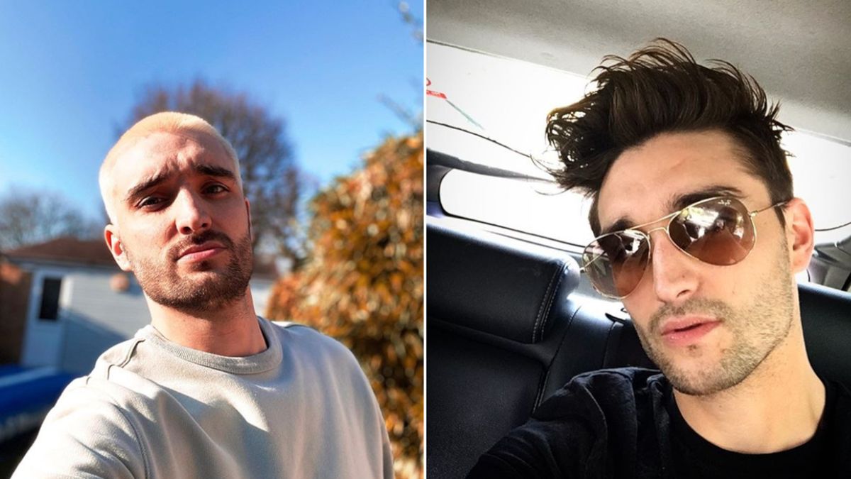 Tom Parker walczy z glejakiem, fot. Instagram @tomparkerofficial