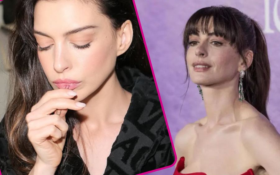 Sprawia wrażenie wiecznie młodej! Lekarz ujawnia, jakim zabiegom poddała się Anne Hathaway! (FOTO)