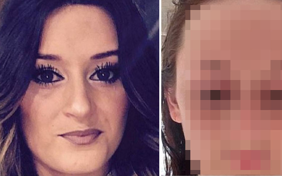 Ta operacja zmieniła jej życie. Wcześniej musiała ukrywać TO pod grzywką