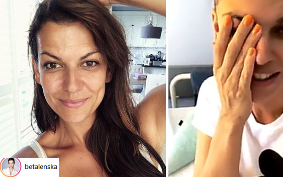 Alżbeta Lenska pokazała WIELKĄ bliznę po operacji