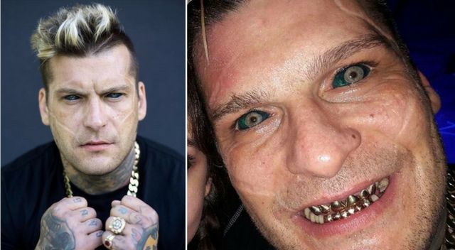 untitled-design-1-kopia-R1