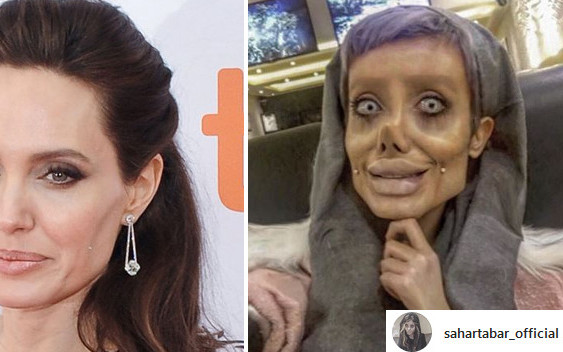 Jej marzeniem było być jak Angelina Jolie, a teraz STRASZY swoim wyglądem