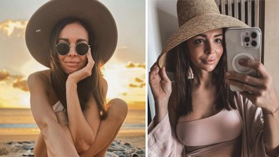 Co się dzieje z twarzą Ani Wendzikowskiej? Fani martwią się o dziennikarkę