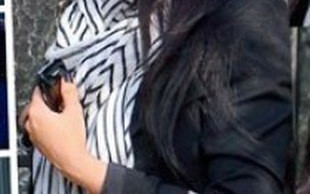 Kim Kardashian i jej napompowane usta (FOTO)