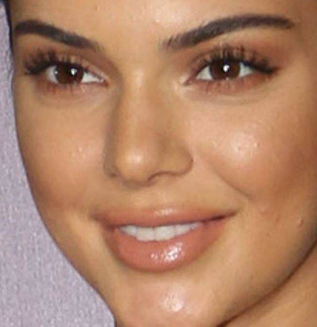 Trądzik i napompowane usta Kendall Jenner – zoom na twarz modelki