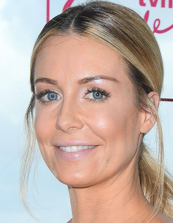 Fanki na Instagramie Małgorzaty Rozenek: Co ty z buzią zrobiłaś? Tragedia!