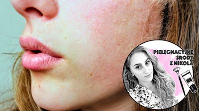 Zadbaj o cerę po lecie – sposoby na nawilżenie suchej i odwodnionej skóry (PIELĘGNACYJNE ŚRODY)