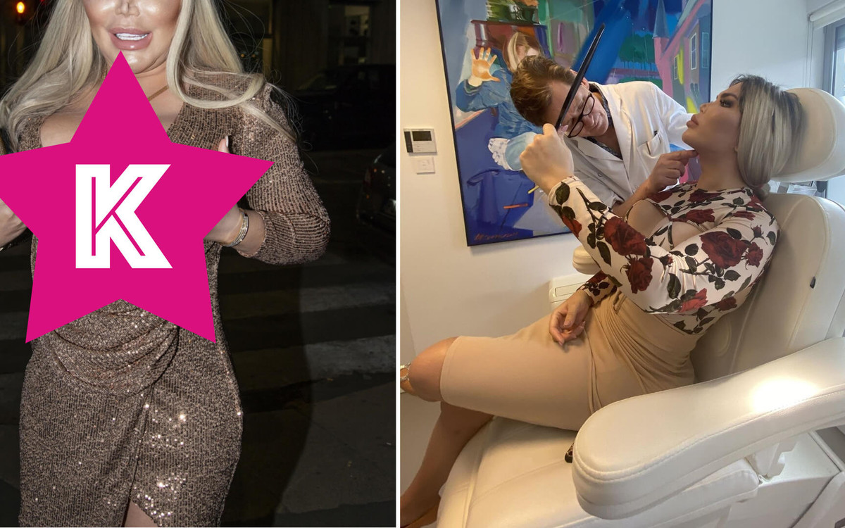 Te zdjęcia powinno się pokazywać jako przestrogę przed operacjami plastycznymi. Roddy Alves straszy w Mediolanie