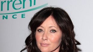 Dlaczego Shannen Doherty ma furtkę między zębami?