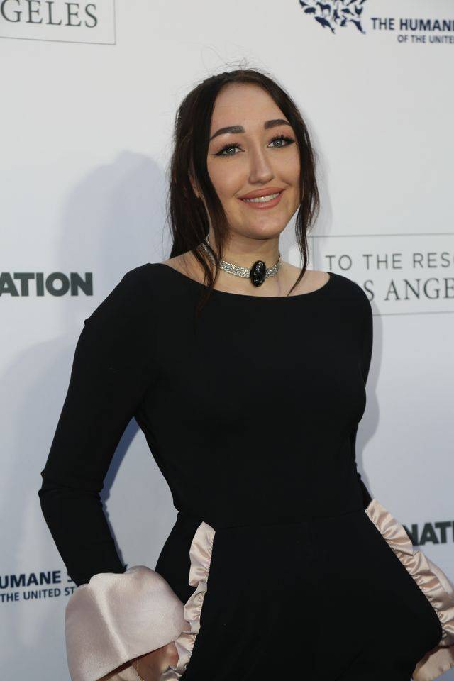 OMG! Co się dzieje z twarzą Noah Cyrus?!